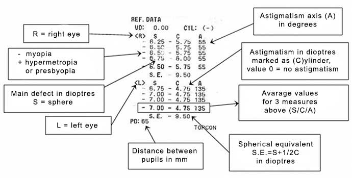 Annotated printout from a computerized eye examination